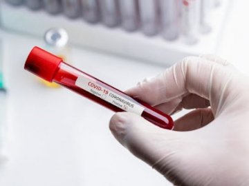 В Україні за добу – майже 2500 нових випадків коронавірусу