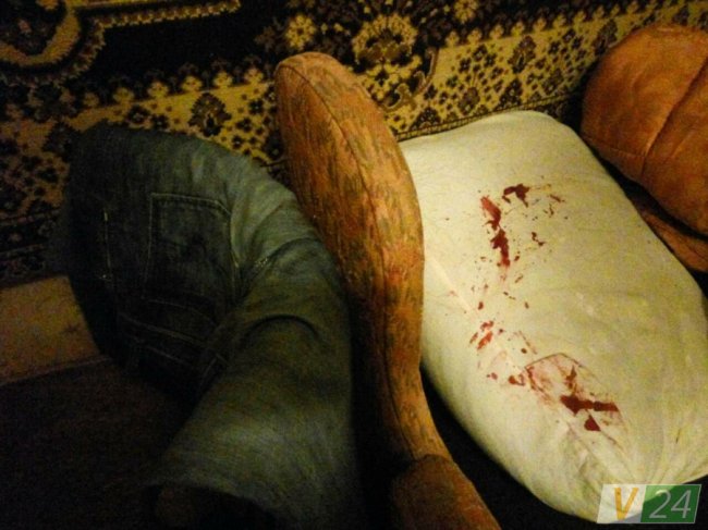  Приревнував: п’яний лучанин до крові побив дружину. ФОТО