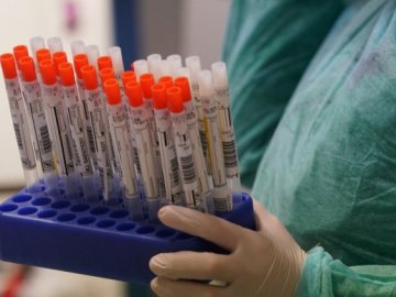 Повідомили статистику щодо коронавірусу в Україні за останній день 2020-го