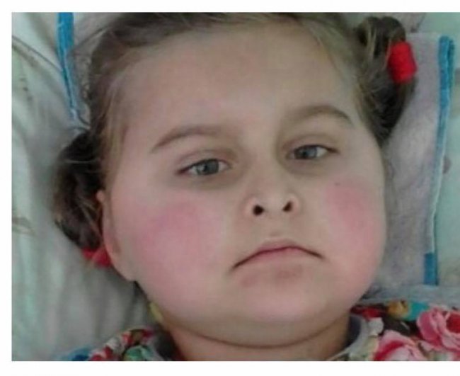 Благають про допомогу маленькій помираючій волинянці