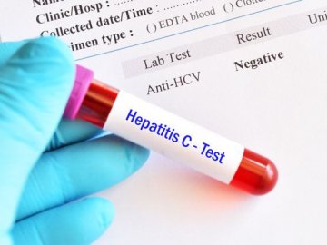 На Волині у 28 новонароджених дітей виявили ВІЛ