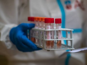 Повідомили статистику щодо коронавірусу в Україні за минулу добу