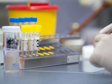 Україна отримала перші 200 тисяч ПЛР-тестів вітчизняного виробництва