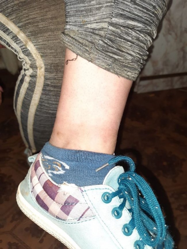 Знущання з дитини: на Луганщині жінка посадила свою доньку на ланцюг. ФОТО