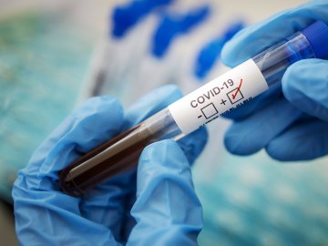 На Волині за добу виявили двох хворих на коронавірус