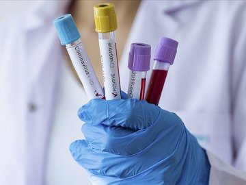 За минулу добу на Волині виявили трьох хворих на коронавірус