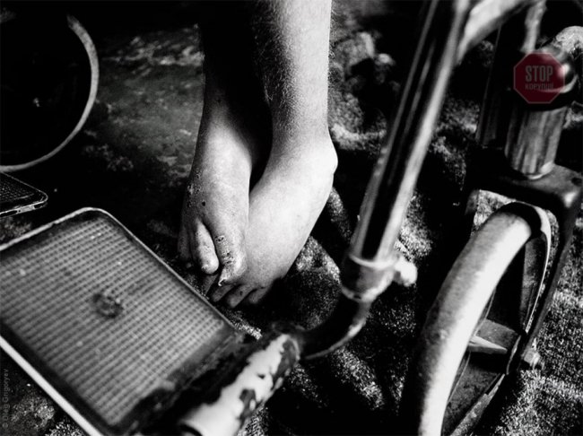 На Дніпропетровщині жорстоко знущаються над пацієнтами у інтернаті. ФОТО