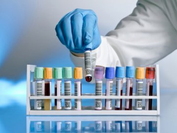 В Україні – 876 нових випадків коронавірусу за останню добу, з них на Волині – 63