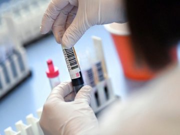 Кількість одужалих від коронавірусу за добу в Україні знову перевищила кількість нових хворих