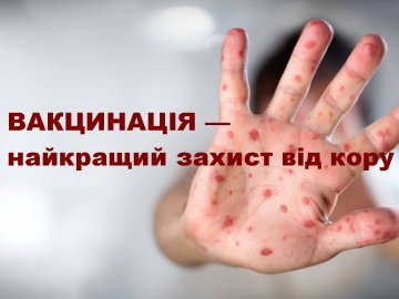 На Волині більшає хворих на кір. Влада закликає робити щеплення