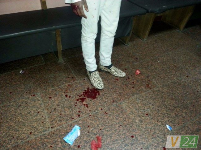 У Луцьку п'яний африканець дебоширив у відділку поліції