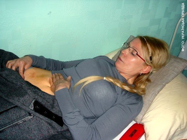 Тимошенко показала свої синці