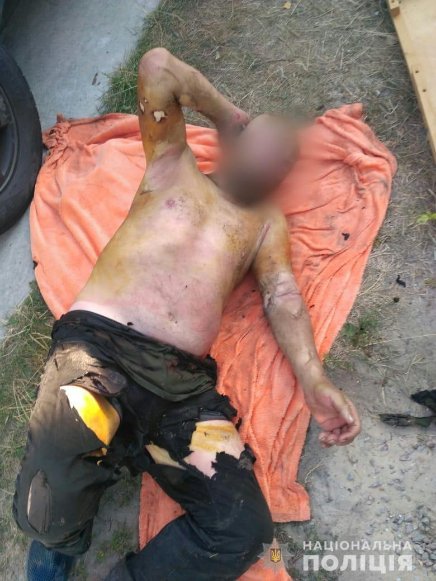 Після сварки з дружиною чоловік облився бензином і підпалив себе. ФОТО