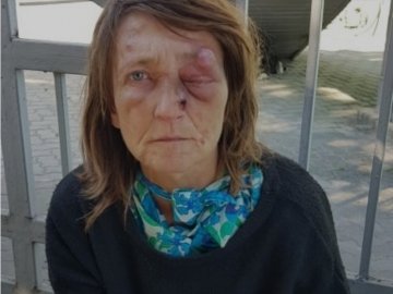 Жебракує, голодує і ночує у під’їзді: необхідна допомога психічнохворій жінці з Луцька