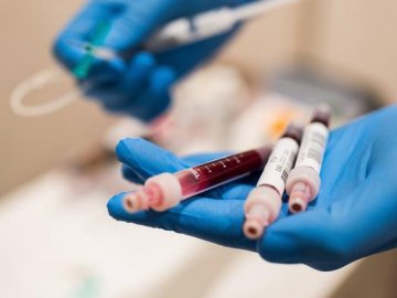 В Україні знову – майже тисяча нових хворих на COVID-19 за добу