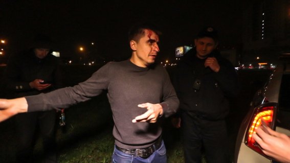 У Києві п'янючий водій розніс вщент сім автомобілів. ФОТО