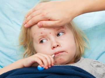 Біда вчить: на Волині побільшало дітей, вакцинованих від кору