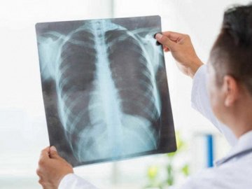 На Волині  за 2 місяці від пневмонії померло понад 30 людей