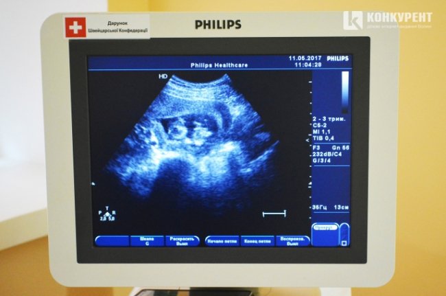 Ультразвуковий апарат Philips