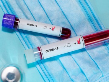 Карта коронавірусних закупівель: стало відомо, що для захисту та боротьби із COVID-19 купує Волинь