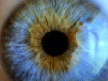 Навіщо робити лазерну корекцію зору*