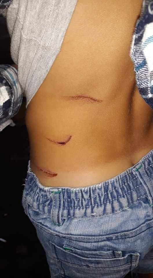 У Луцьку через небезпечну гірку травмувалась дитина. ФОТО