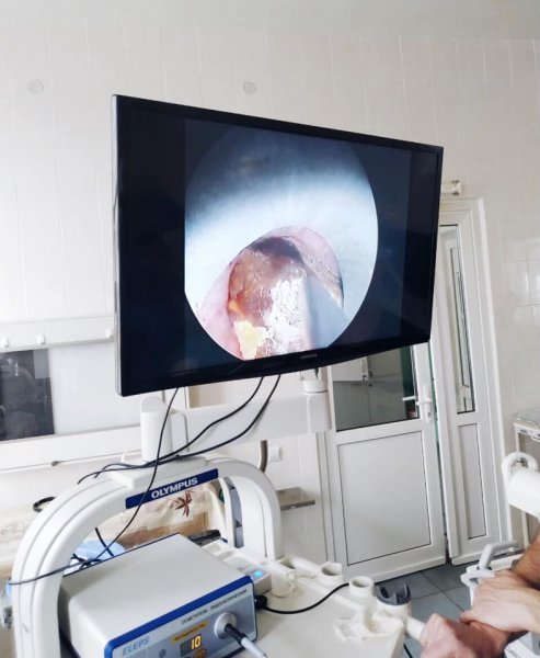 Волинські медики провели п'ять технічно найскладніших операцій в урології. ФОТО