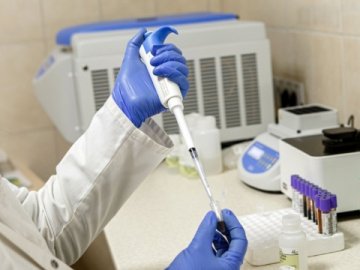 Коронавірус в Україні: які показники зафіксували за минулу добу