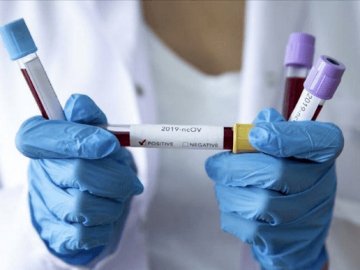 Повідомили статистику щодо коронавірусу в Україні за добу