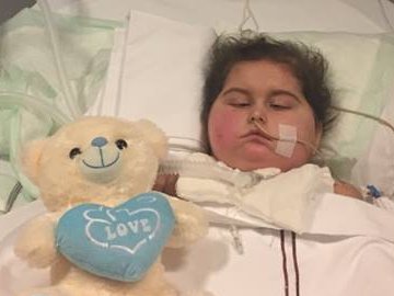 Дівчинка з Волині продовжує боротьбу за життя