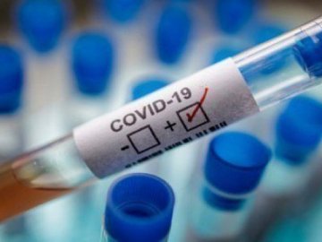 У Володимирі через випадки COVID-19 частково закривають птахофабрику