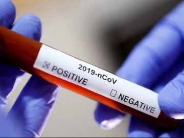 Одна смерть і 55 нових випадків: ситуація з коронавірусом на Волині станом на 11 липня
