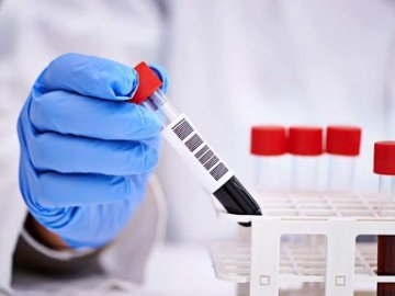 Коронавірус на Волині: повідомили ситуацію за останню добу