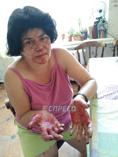 Під Києвом побили жінку через зауваження не смітити