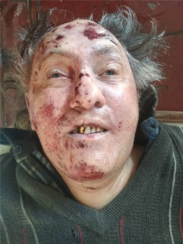  Поліція просить впізнати загиблого у аварії чоловіка. ФОТО 18+