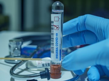 Одна смерть і 86 нових випадків: ситуація з коронавірусом на Волині станом на 19 серпня