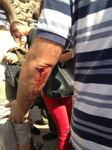 Як «Беркут» бив народного депутата. ВІДЕО