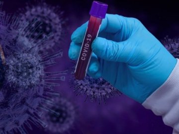 Повідомили, скільки нових заражених коронавірусом виявили в Україні за останню добу