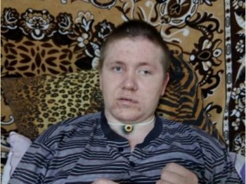 Хлопцю з Волині, якого сильно побив друг і залишив помирати біля лісу, потрібні кошти на лікування