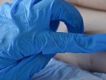 Хвороба Фабрі: на Волині діагностували рідкісну недугу. ВІДЕО