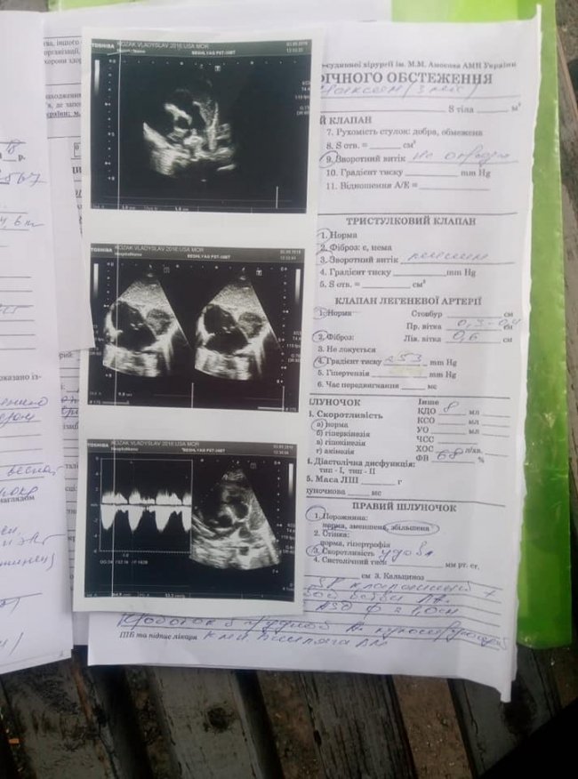 Немовля волинського атовця потребує негайної допомоги