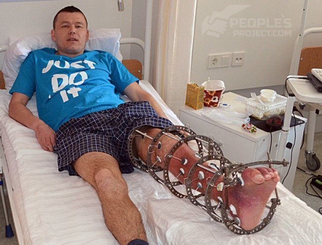 Терміново прооперували волинського бійця, який підірвався на розтяжці