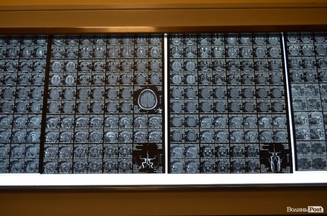 Краще, ніж у Києві: Олександр Савченко оцінив обладнання в обласній лікарні. ФОТО