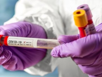 Одна смерть і 11 нових випадків: ситуація з коронавірусом на Волині станом на 9 липня