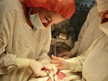 У Луцькій лікарні жінці видалили шестикілограмову пухлину 