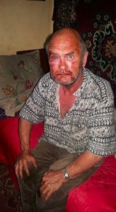 Лучанин ножицями пробив легеню кривднику. ФОТО