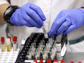 Повідомили статистику щодо COVID-19 в Україні за останню добу