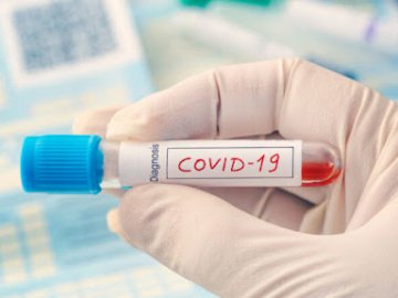 Коронавірус на Волині: за минулу добу – 16 нових випадків недуги