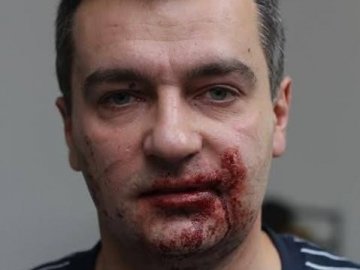 У Києві «тітушки» знов побили журналістів. ВІДЕО