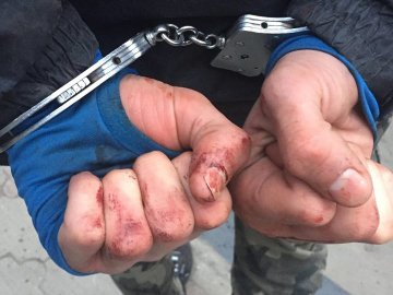 Потерпілого госпіталізували: у Луцьку п'яні підлітки побили та пограбували чоловіка. ФОТО